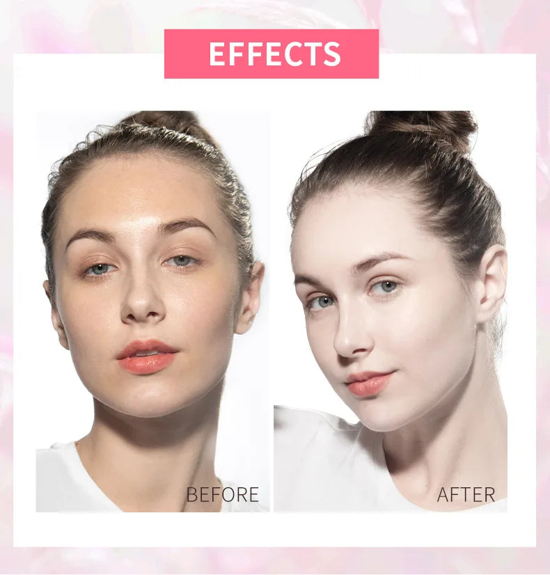 lowRest Mask Set™