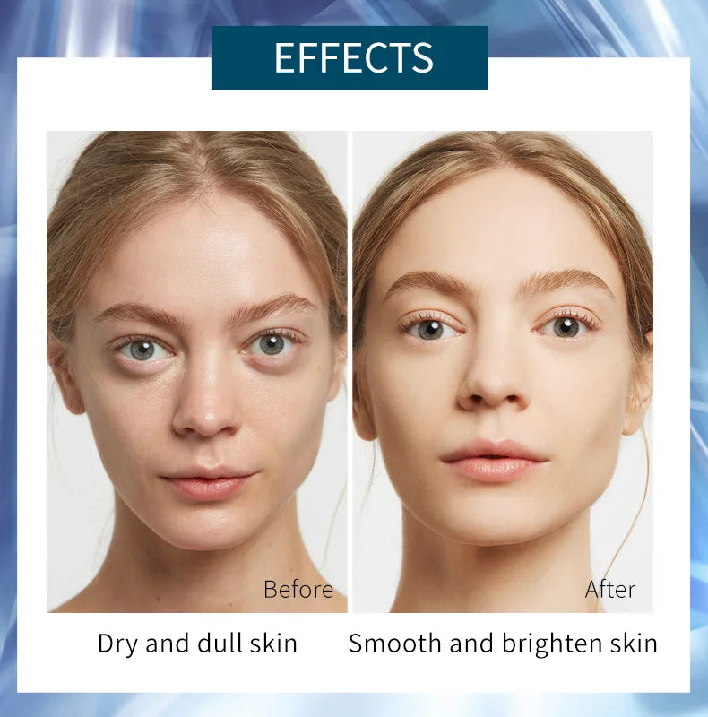 lowRest Mask Set™