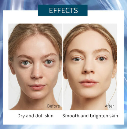 lowRest Mask Set™
